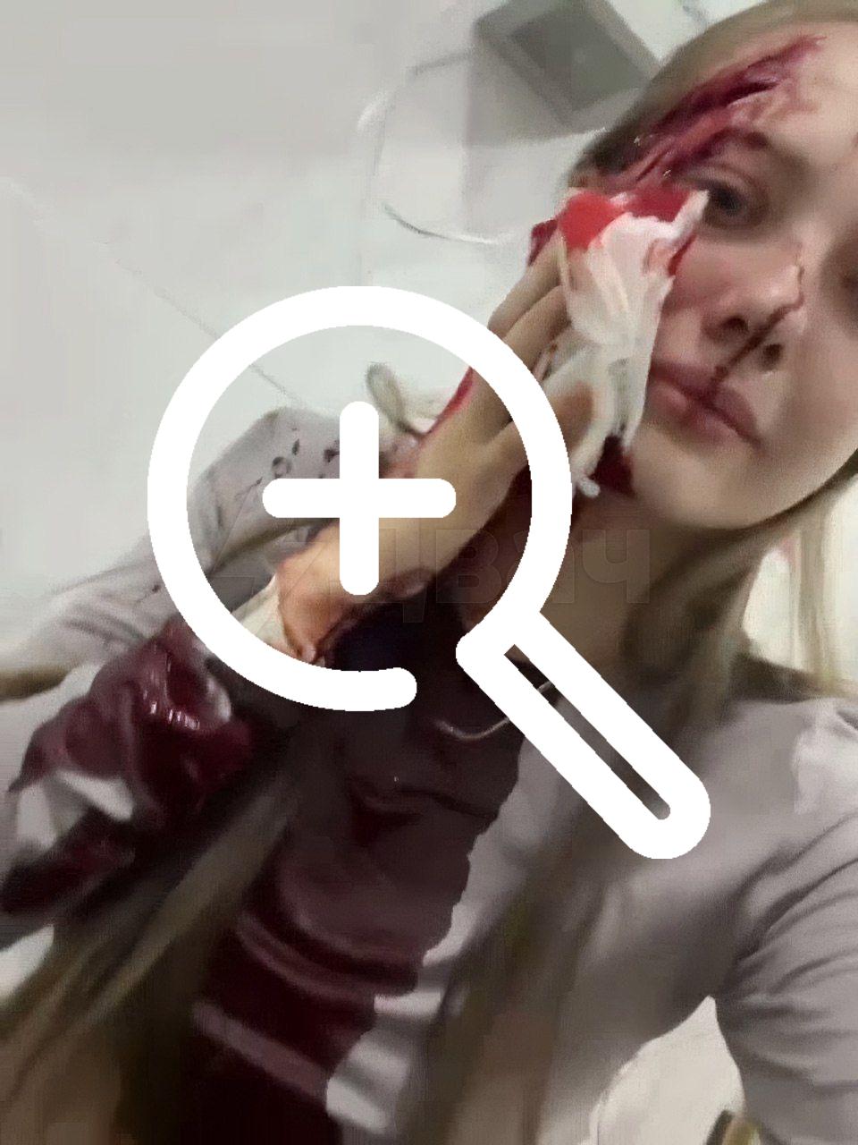 Подошёл, схватил за руку и разбил бокал: девушке изуродовали лицо «розочкой» из-за отказа познакомиться