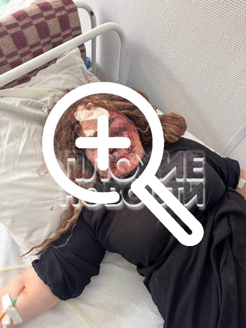 В Екатеринбурге зумеры жестоко избили женщину после замечания вести себя потише