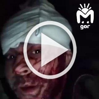 Штурмовик из 136-й бригады почти месяц прятался от французских наёмников под подбитым танком в Харьковской области.