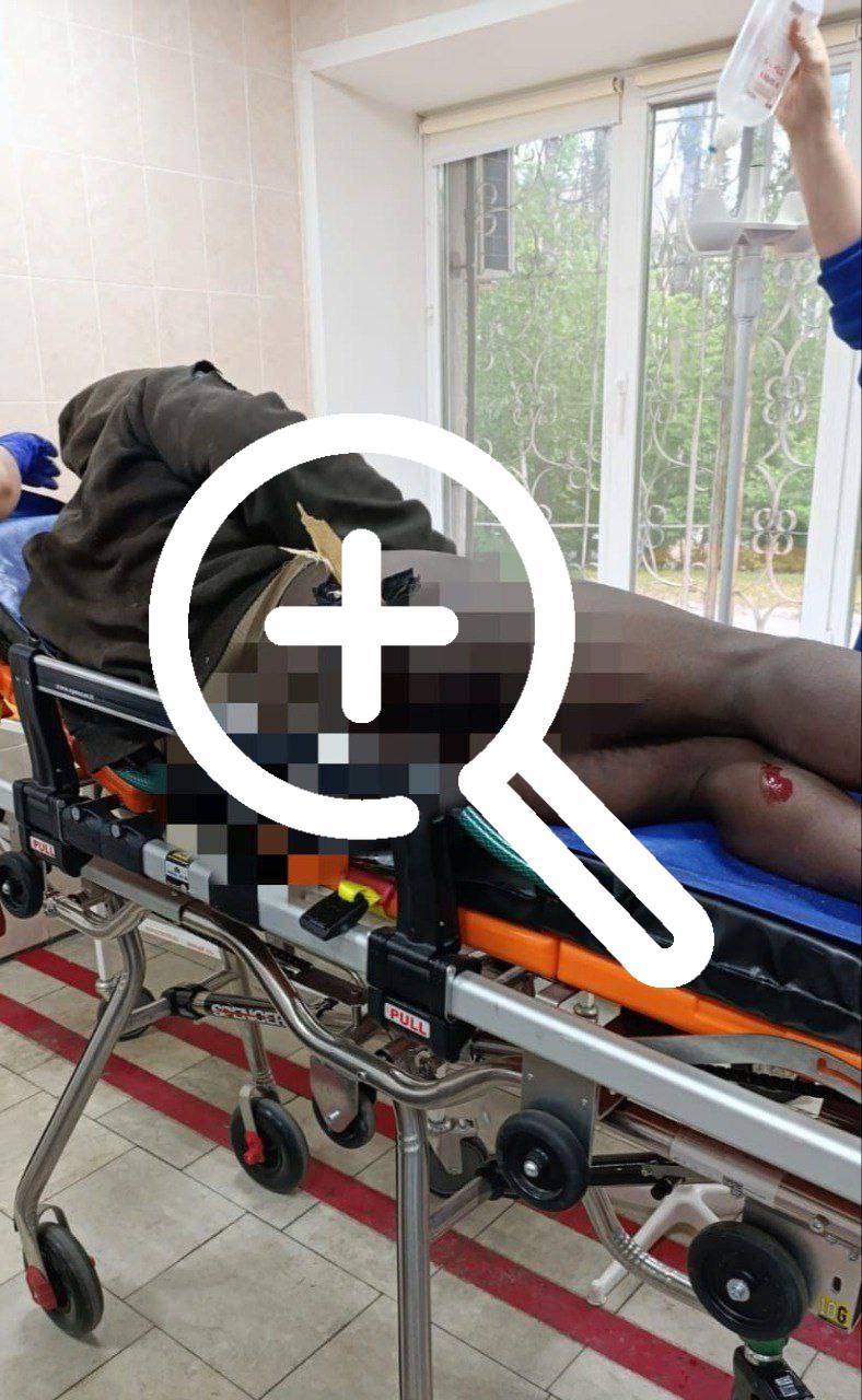 В Липецке нигериец пытался перелезь забор, но сорвался и упал задницей на огромный деревянный кол
