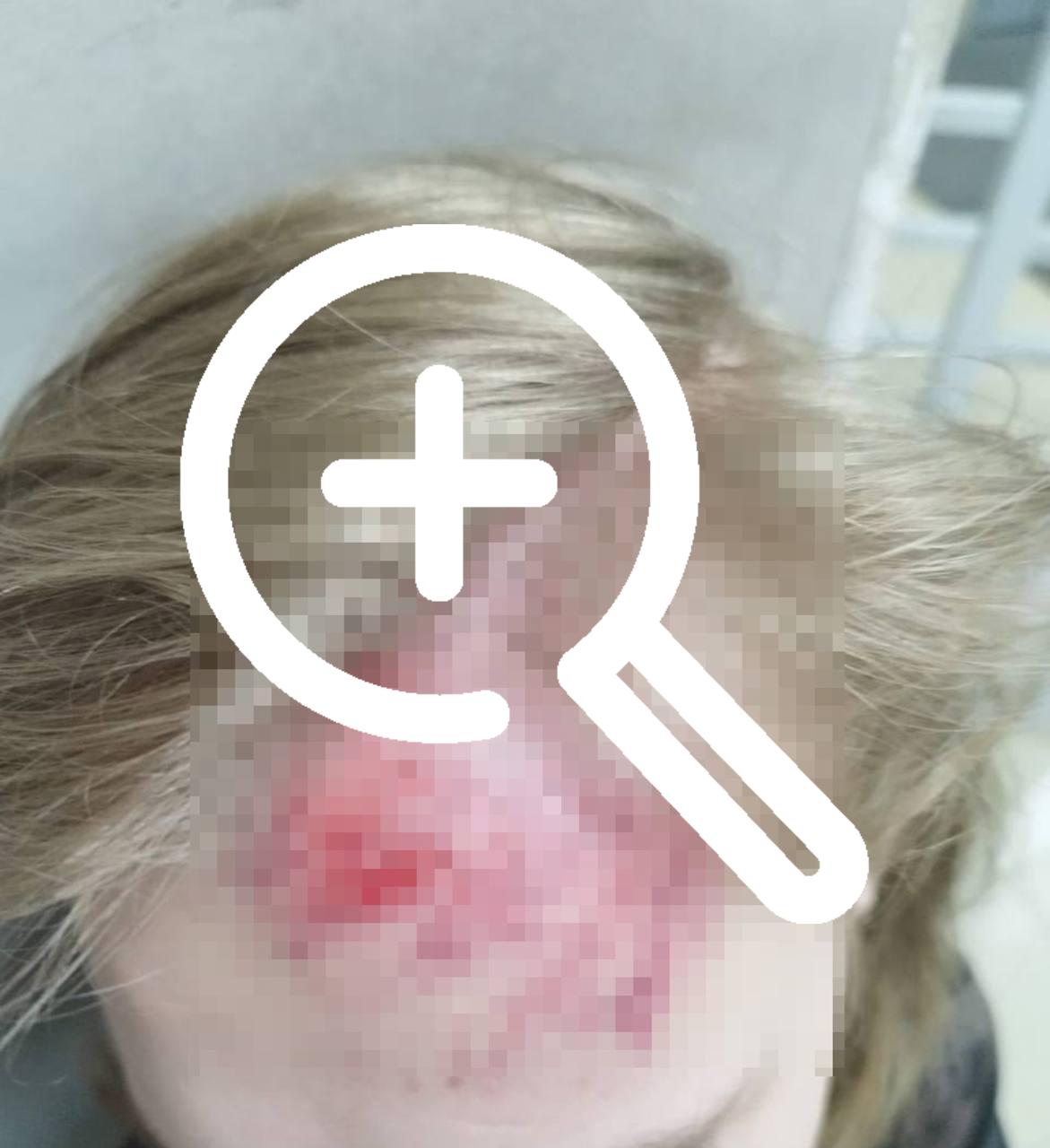 В Петербурге мужчина избил подростка, раскладывавшего рекламные листовки по почтовым ящикам