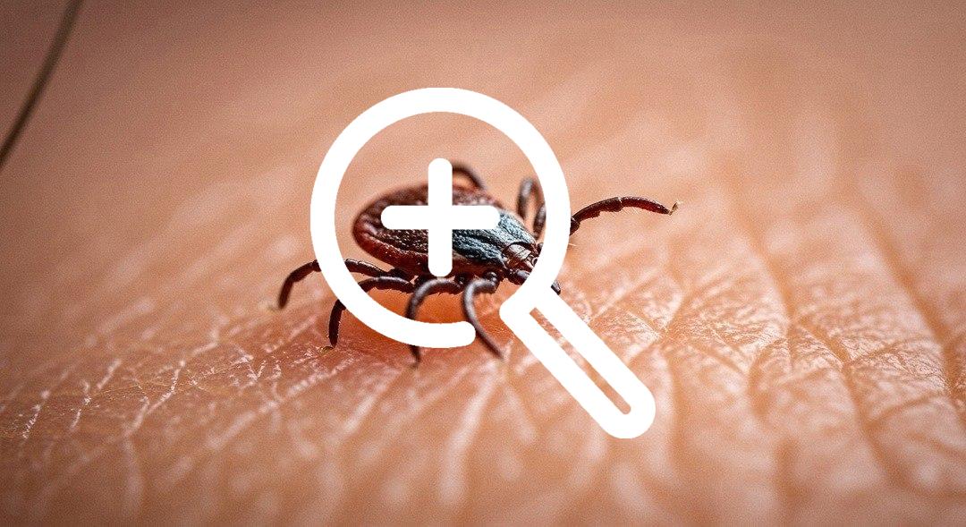 В Новосибирске четыре клеща сняли с пениса мужчины