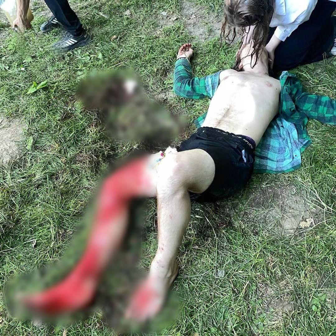 Пьяный неадекват изрезал подростка в Нижнем Новгороде....