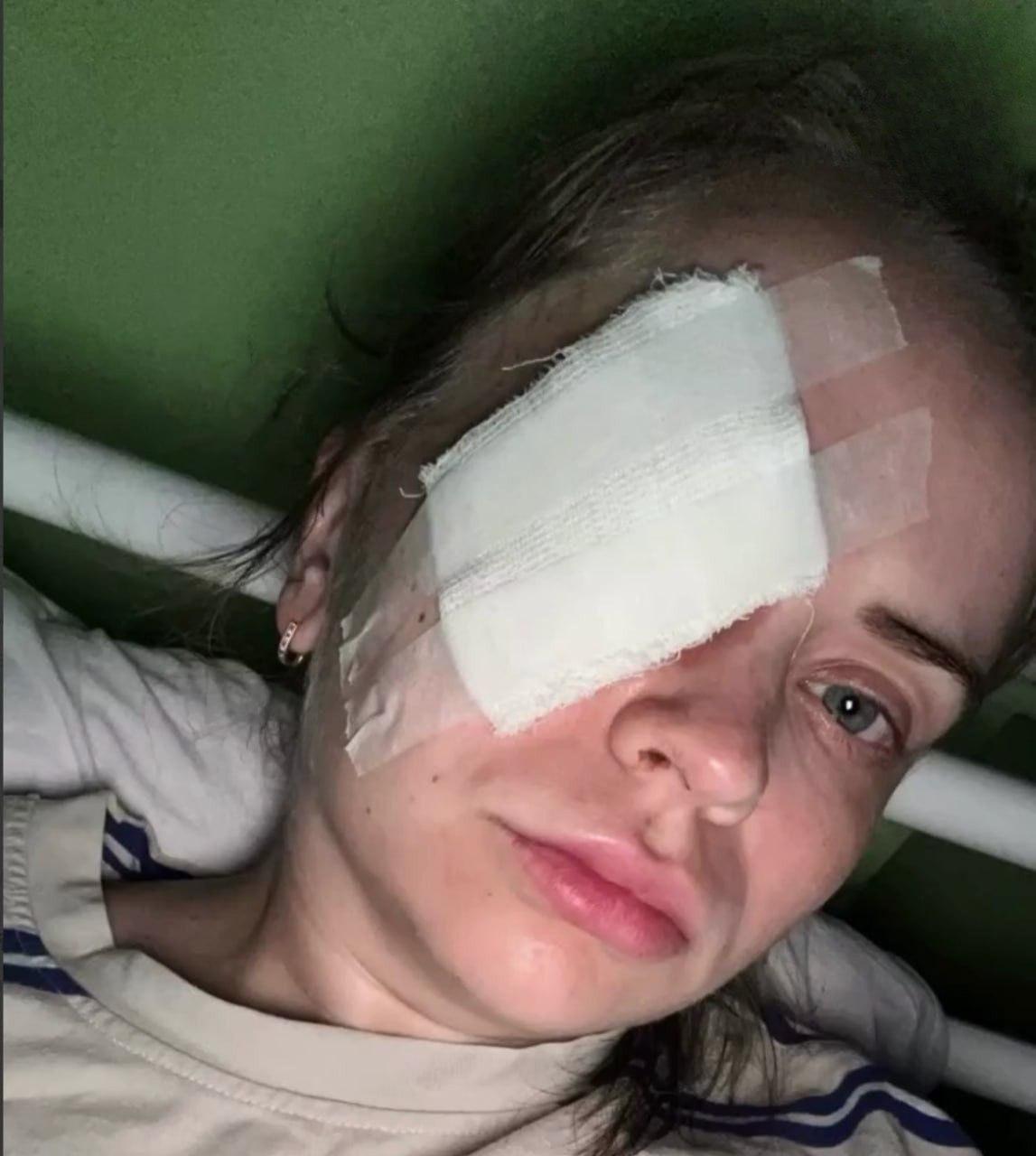Жительница Перми получила пулю в глаз на пробежке. Врачи утверждают, что пострадавшая может остаться без глаза