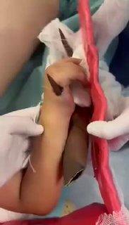 В Виннице (Украина) мальчик чуть не потерял руку из-за спасения кота