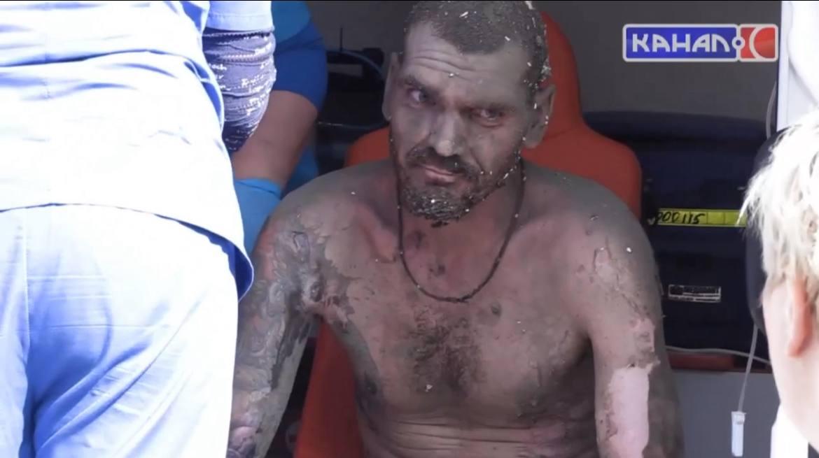 В больнице скончался пострадавший при взрыве газа в Серове