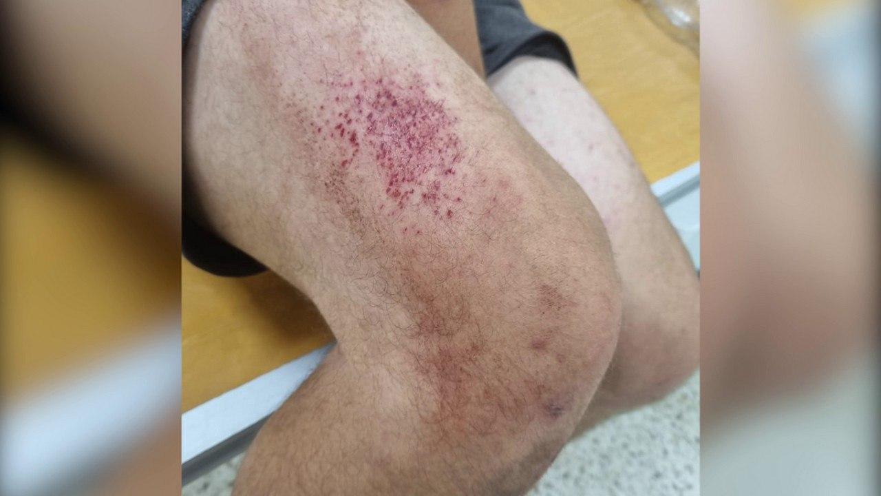 Полицейские избили мужчину и прижгли электрошокером в селе Хреновое