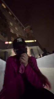 Девушке с вылетевшей челюстью отказали в помощи в травмпункте в подмосковном Долгопрудном