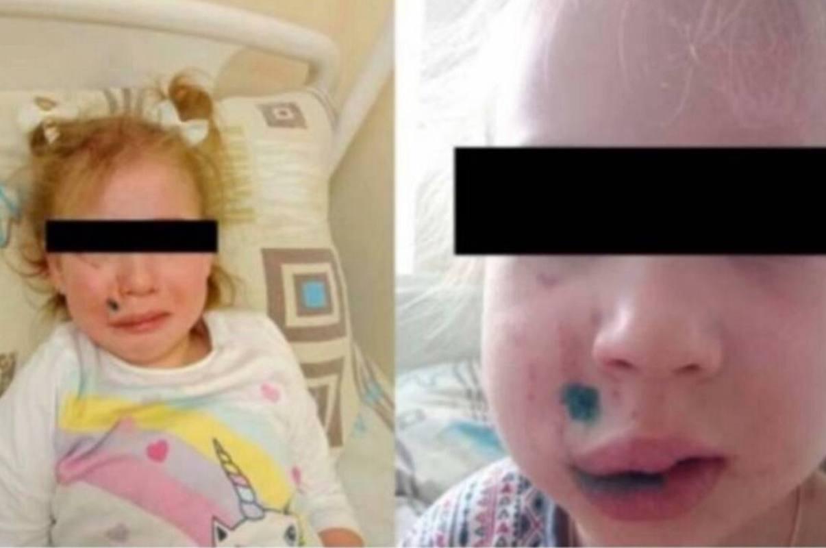 В Брянске с хозяйки кане-корсо требует полмиллиона за укус 4-летней девочки