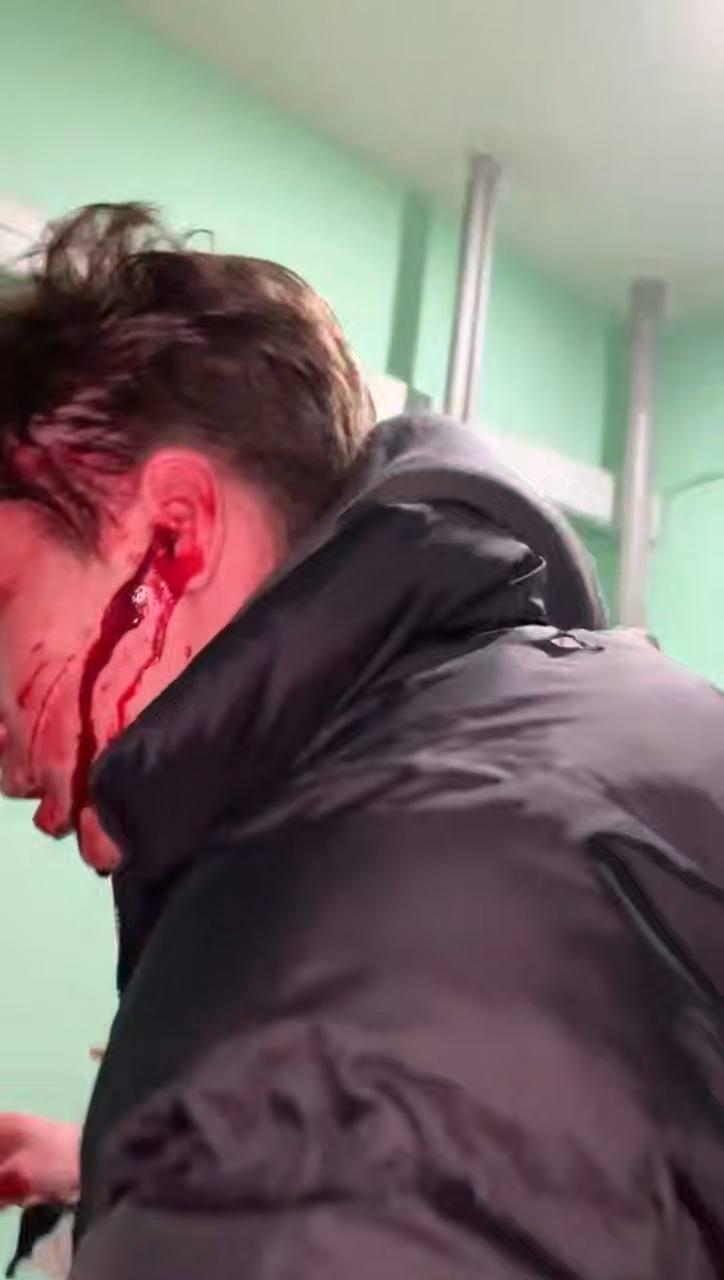 Ебн*тый Неадекватный зумер под наркотой покромсал друга ножом