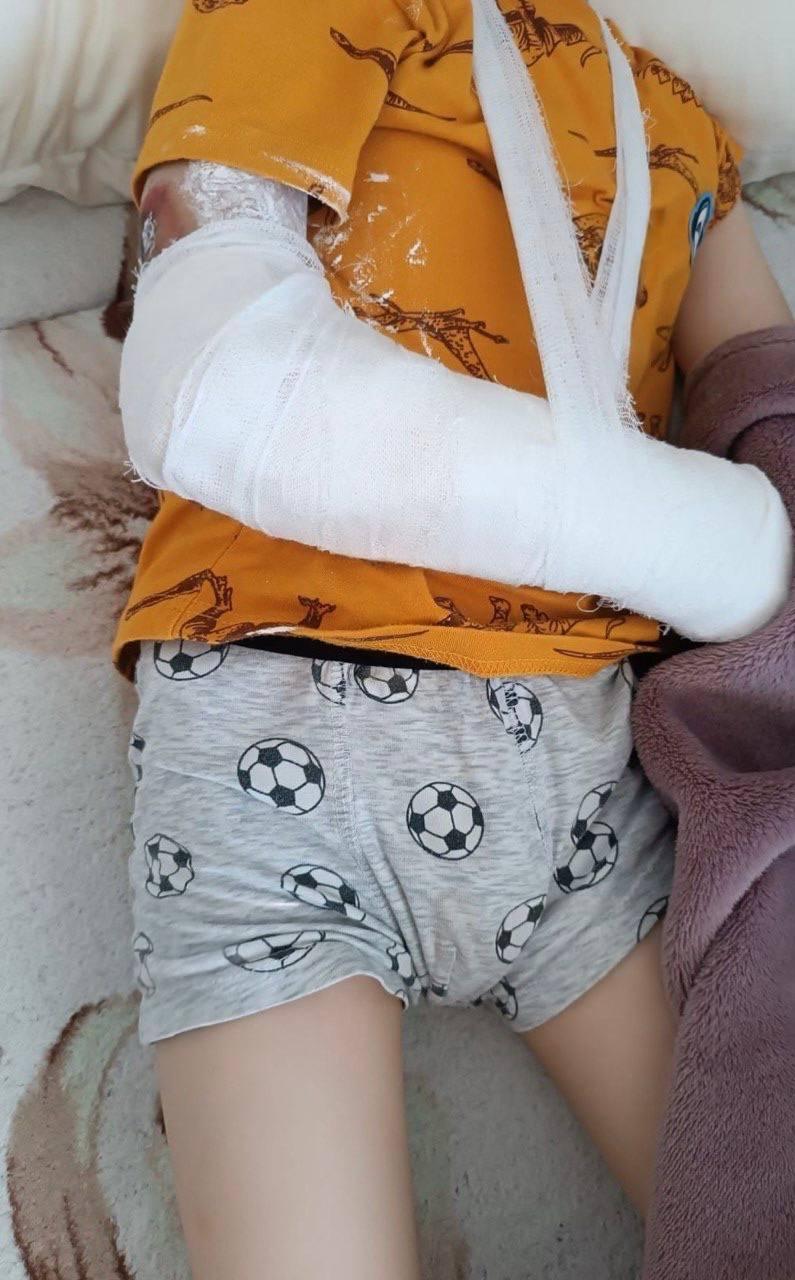 В Питере на вокзале 4-летнего ребёнка затянуло в аппарат досмотра: мальчик получил серьезный перелом и травмы