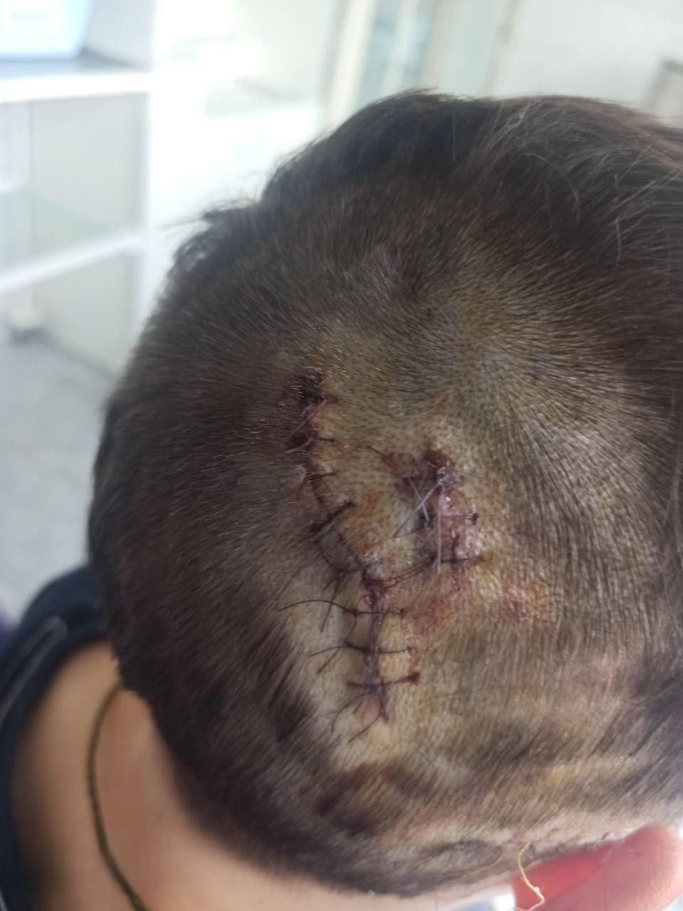 В Москве любимая собака чуть не сняла скальп с 9-летнего школьника