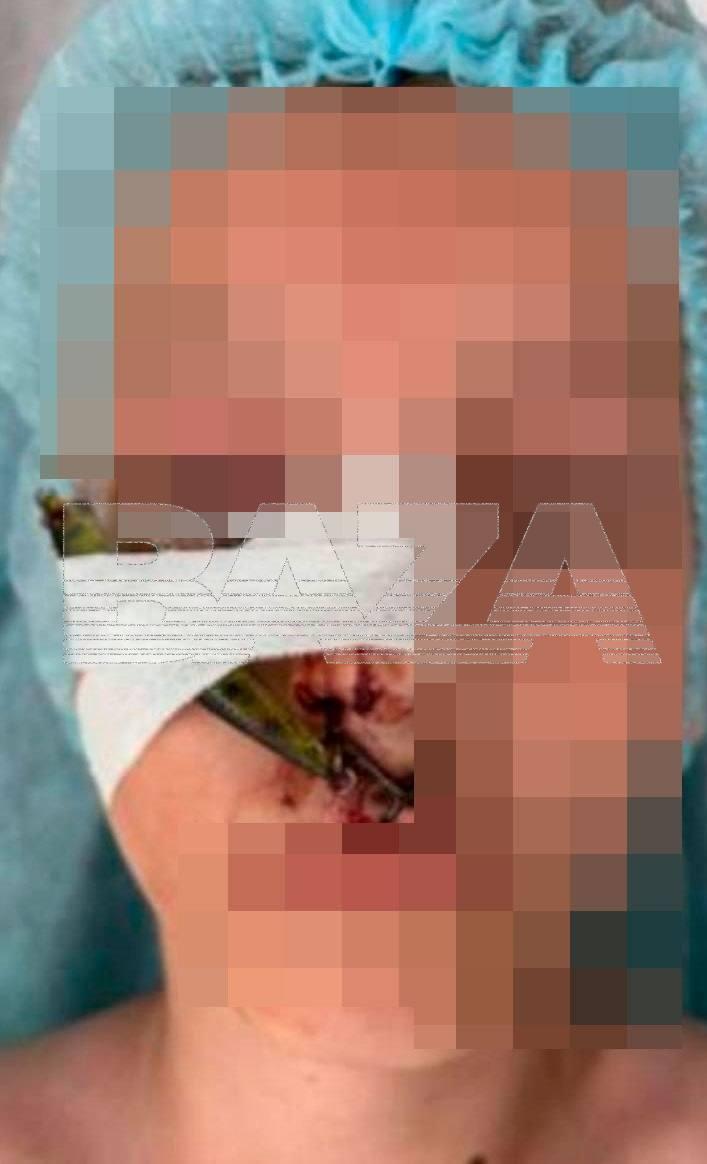 В Подмосковье парень пошёл на леща и поймал сам себя.