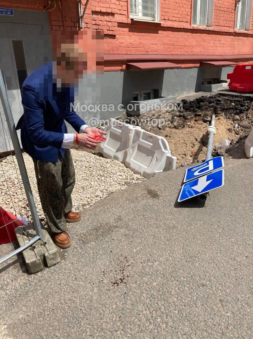 В Гжельском переулке на молодого человека упал дорожный знак. У пострадавшего...