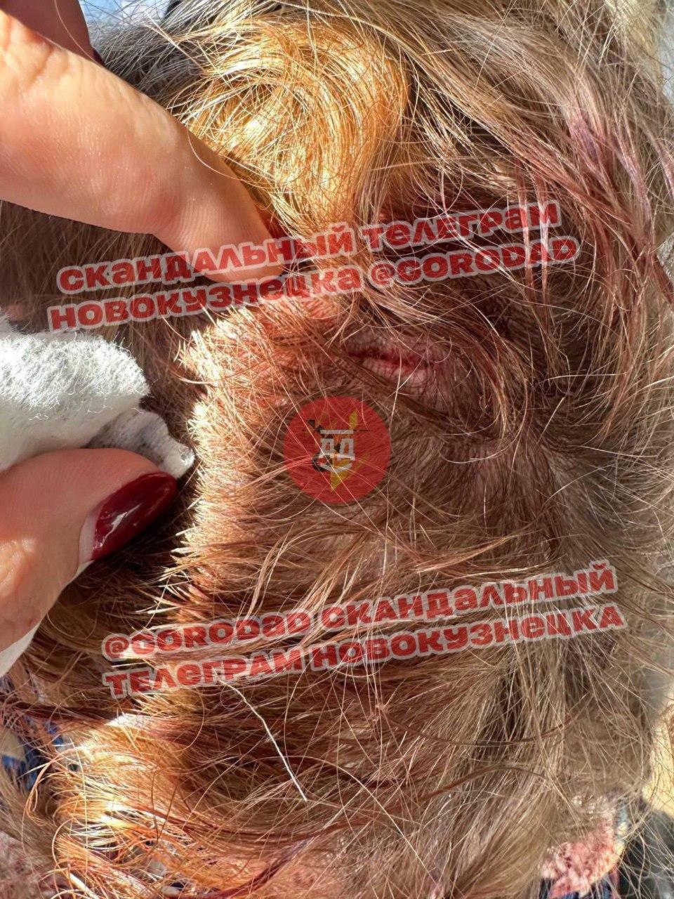 В Новокузнецке на женщину с крыши автобуса упала металлическая деталь