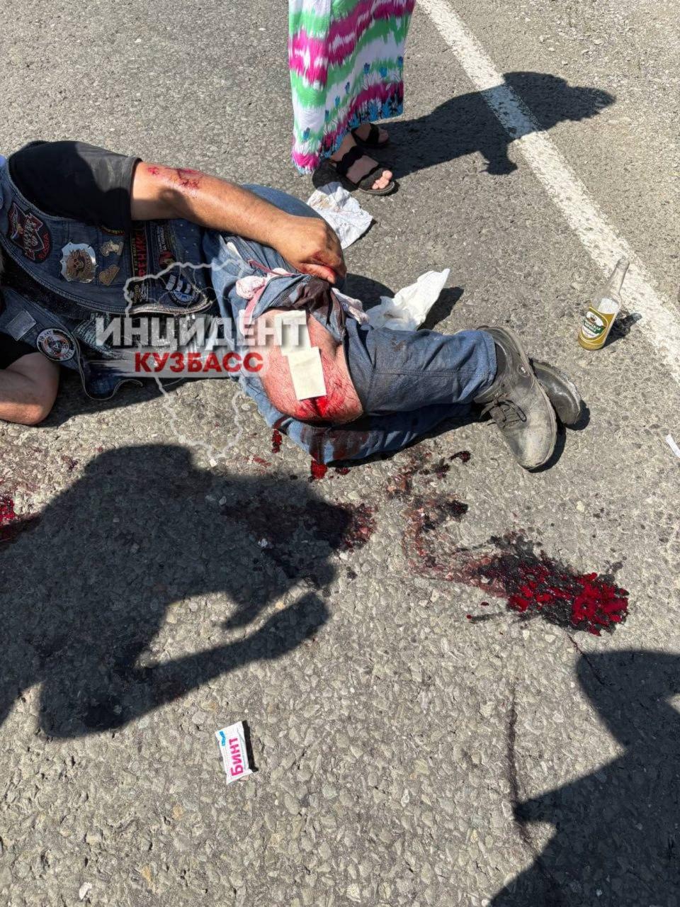 Мотоциклист разбился на автодороге в сторону деревни Подъяково, сообщает читатель.