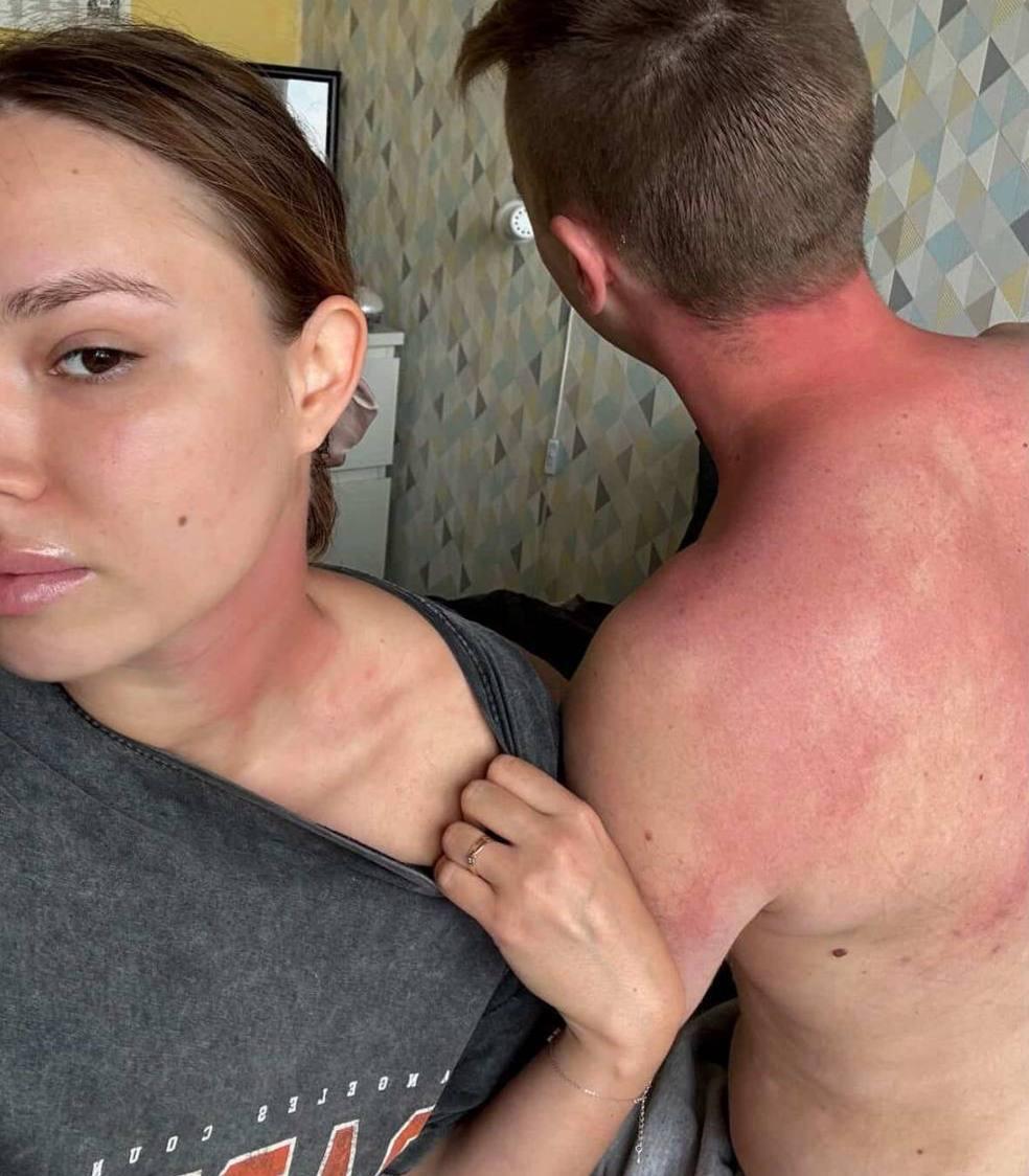 Москвичи решили вылечить боль в шее тайской мазью с ядом скорпиона. Затем им потребовалось «противоядие»