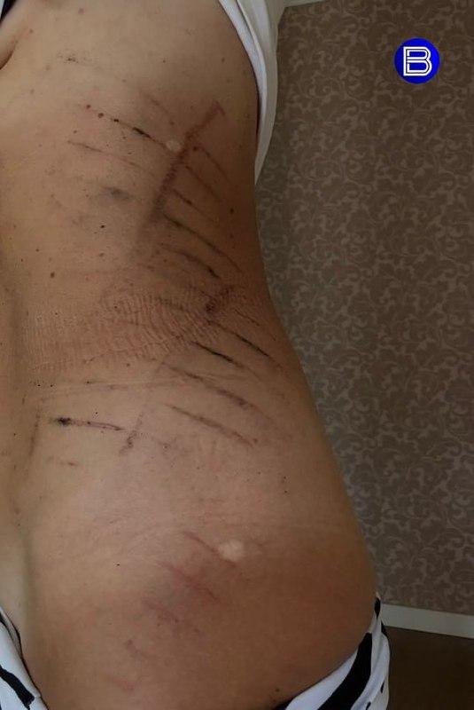 В Новосибирске конфликт из-за детского сачка на пляже закончился избиением