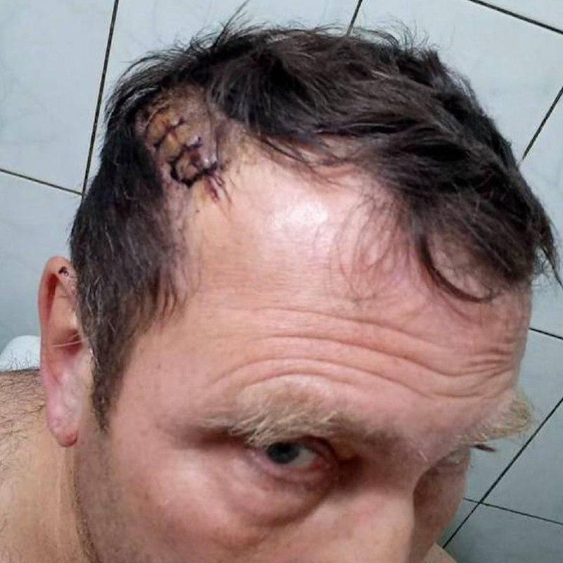 В Свердловской области мужчина пробил соседу голову ломом за просьбу не...