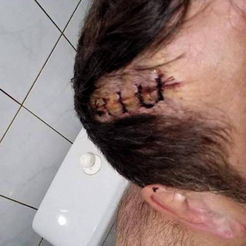 В Свердловской области мужчина пробил соседу голову ломом за просьбу не...
