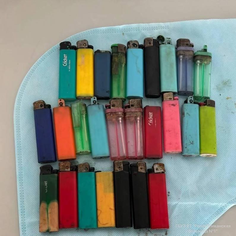 ДВАДЦАТЬ СЕМЬ зажигалок достали из желудка мужчины в Кызыле