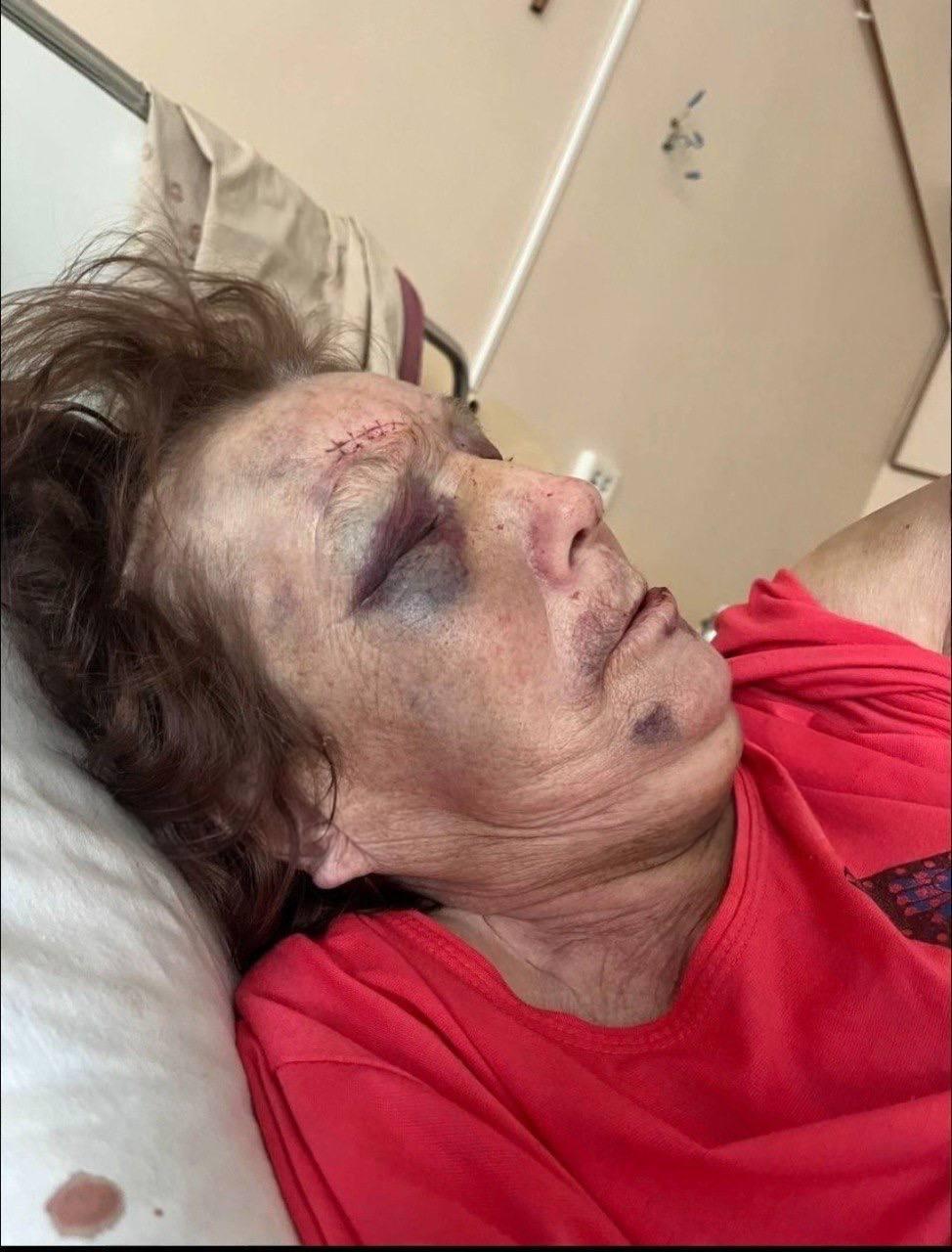 В Петербурге женщина жестоко издевается над 76-летней матерью