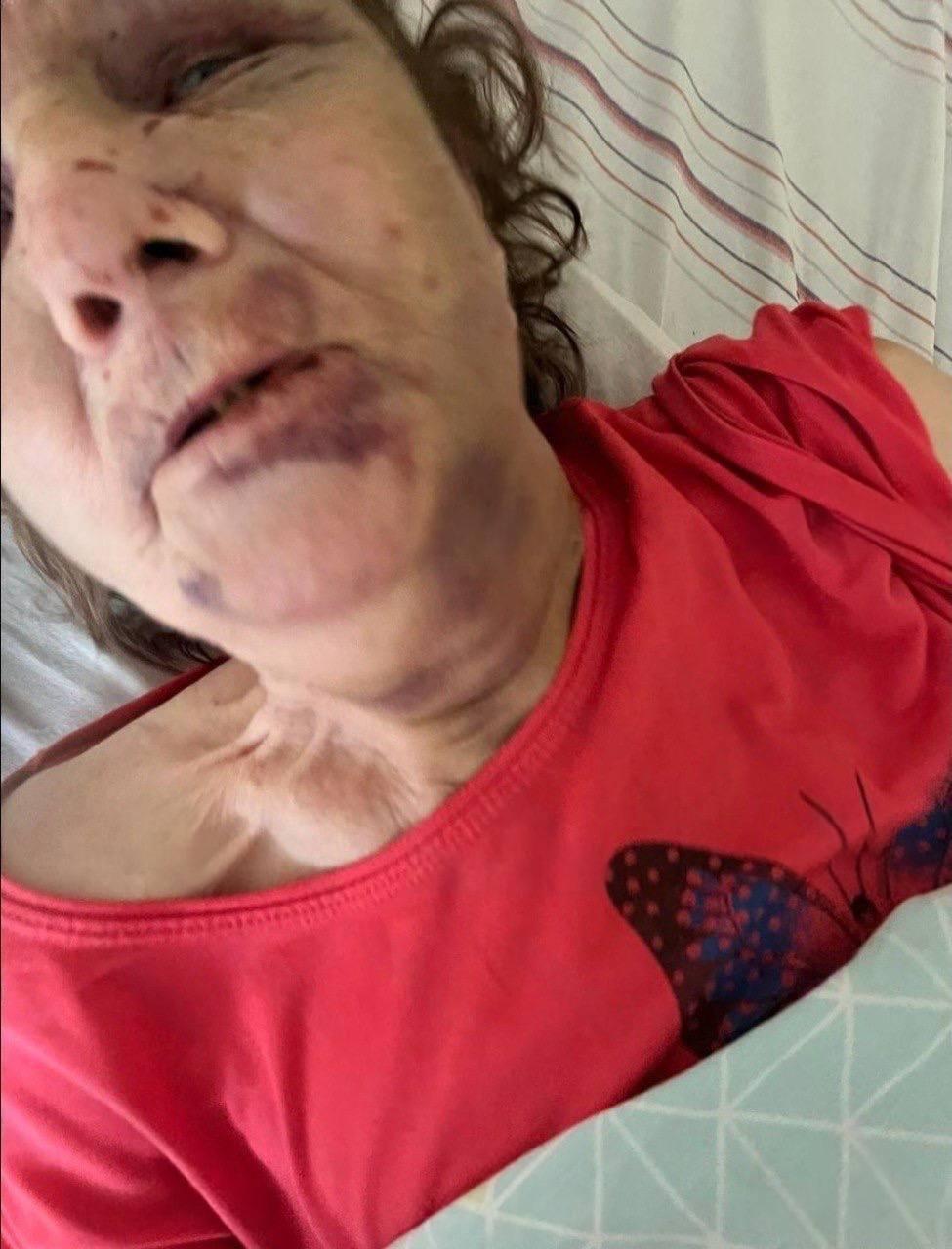 В Петербурге женщина жестоко издевается над 76-летней матерью