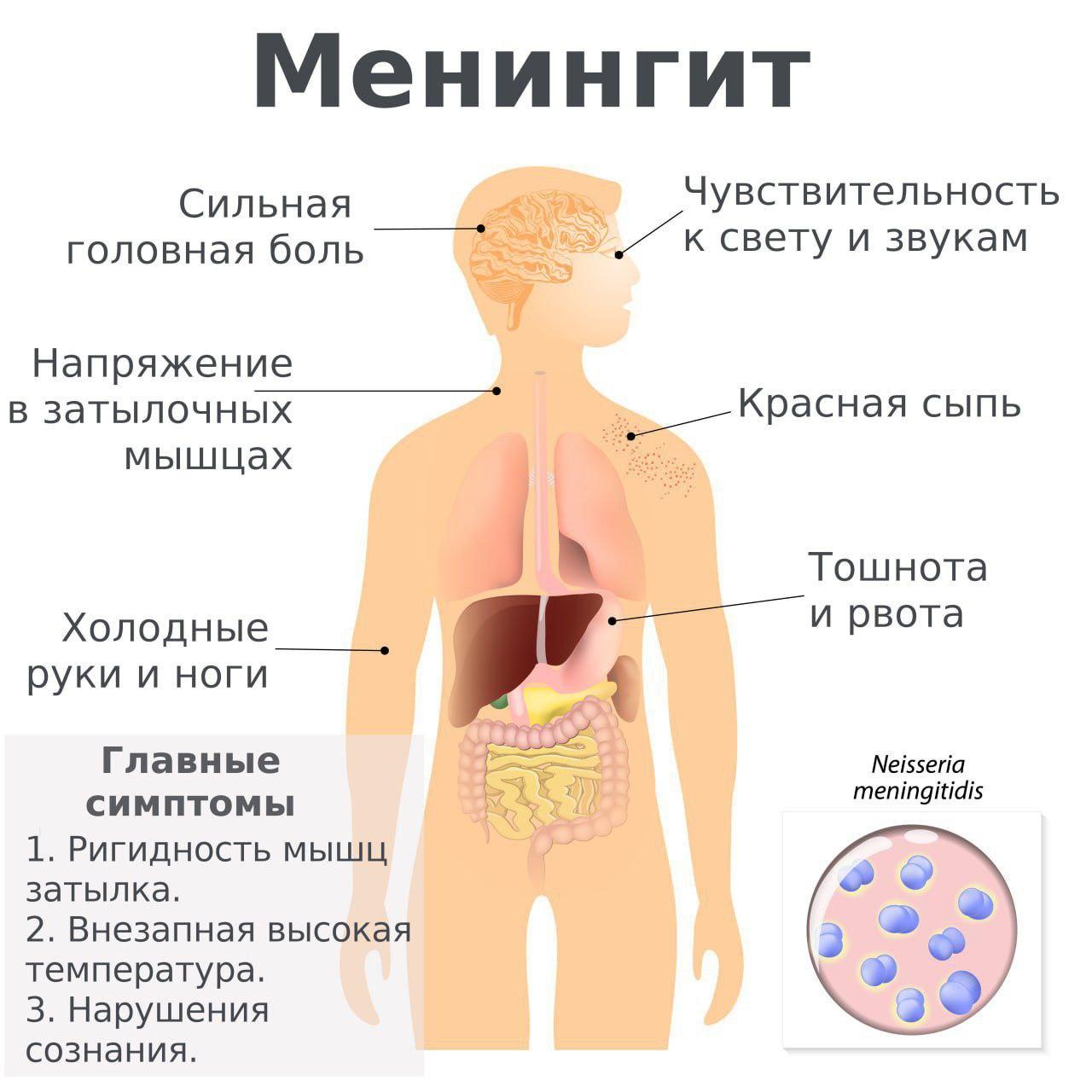 Всплеск смертельно опасного менингита наблюдается в России из-за трудовых мигрантов — Минздрав