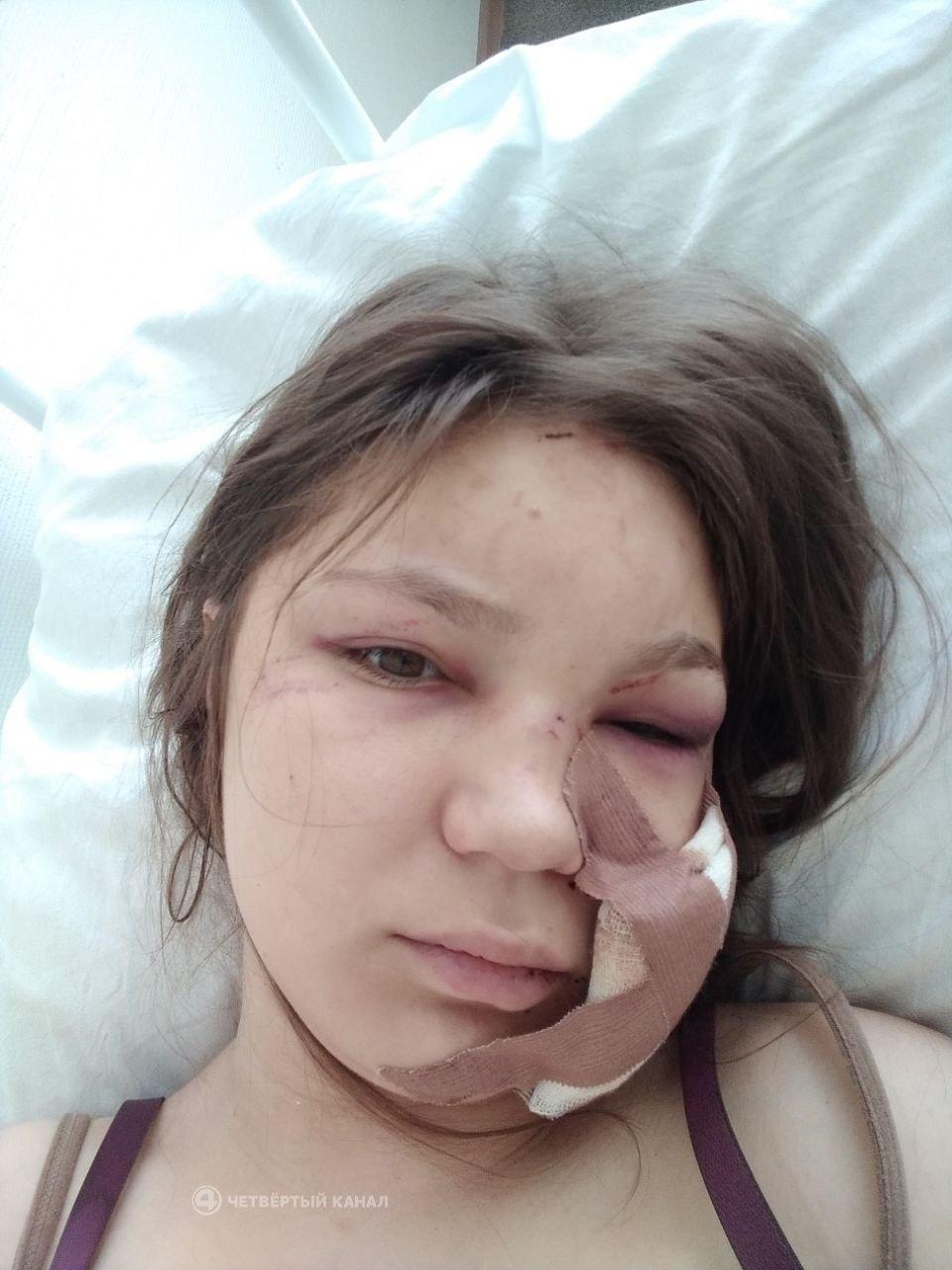 Екатеринбуржец несколько месяцев избивает супругу В микрорайоне 