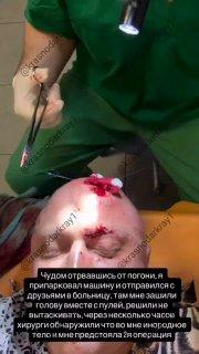 В Краснодаре мужчина получил пулю в лоб после конфликта в ночном клубе.