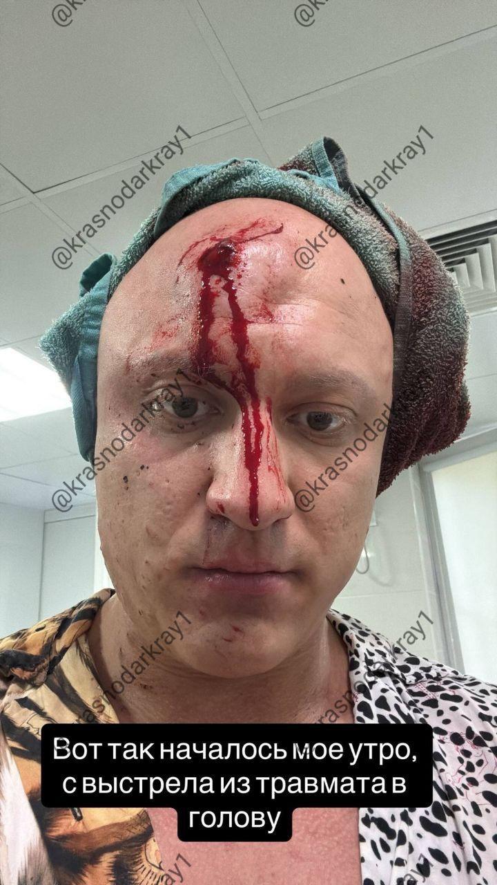 В Краснодаре мужчина получил пулю в лоб после конфликта в ночном клубе.