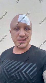 В Краснодаре мужчина получил пулю в лоб после конфликта в ночном клубе.