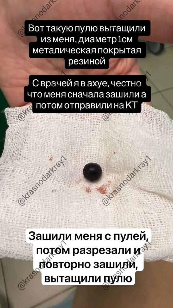 В Краснодаре мужчина получил пулю в лоб после конфликта в ночном клубе.