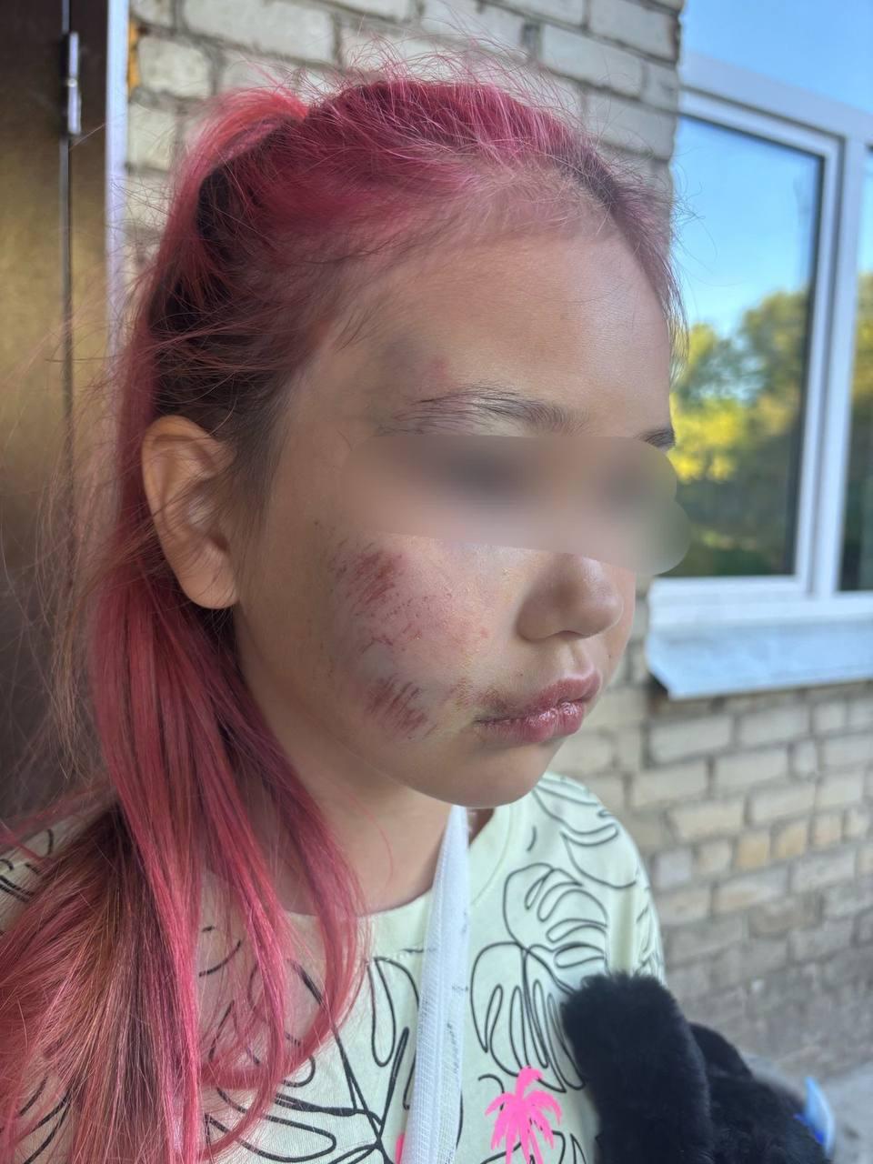 В Каменске-Уральском возбуждено уголовное дело после травмирования 8-летней девочки в детском лагере