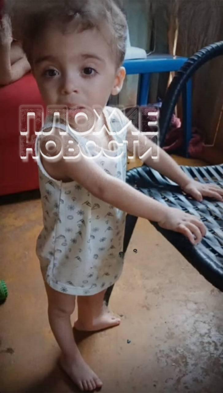 В Бразилии мать избила маленького сына из-за его плача, а затем откусила ему губы