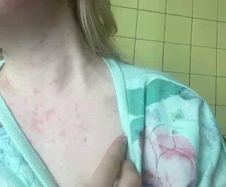 Петербурженка попала в больницу с тяжёлой сыпью и отёками после 12-часовой смены на складе OZON в Шушарах.