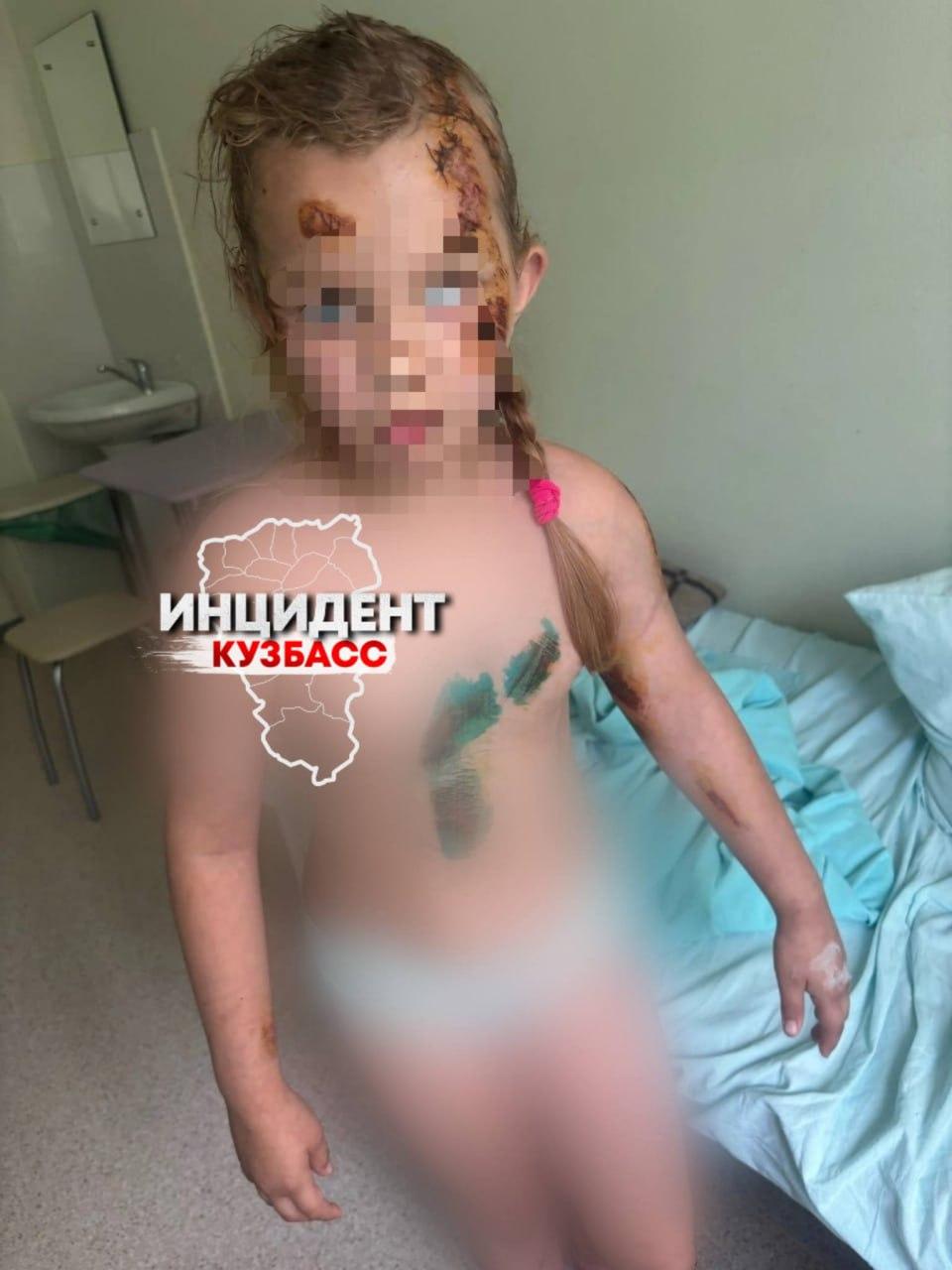 Мотоциклист сбил 8-летнюю девочку в Промышленной и скрылся. Виновника так и не нашли, а семья в отчаянии.