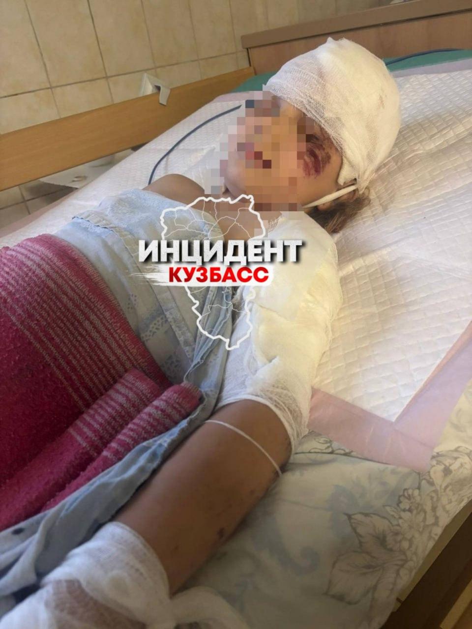 Мотоциклист сбил 8-летнюю девочку в Промышленной и скрылся. Виновника так и не нашли, а семья в отчаянии.