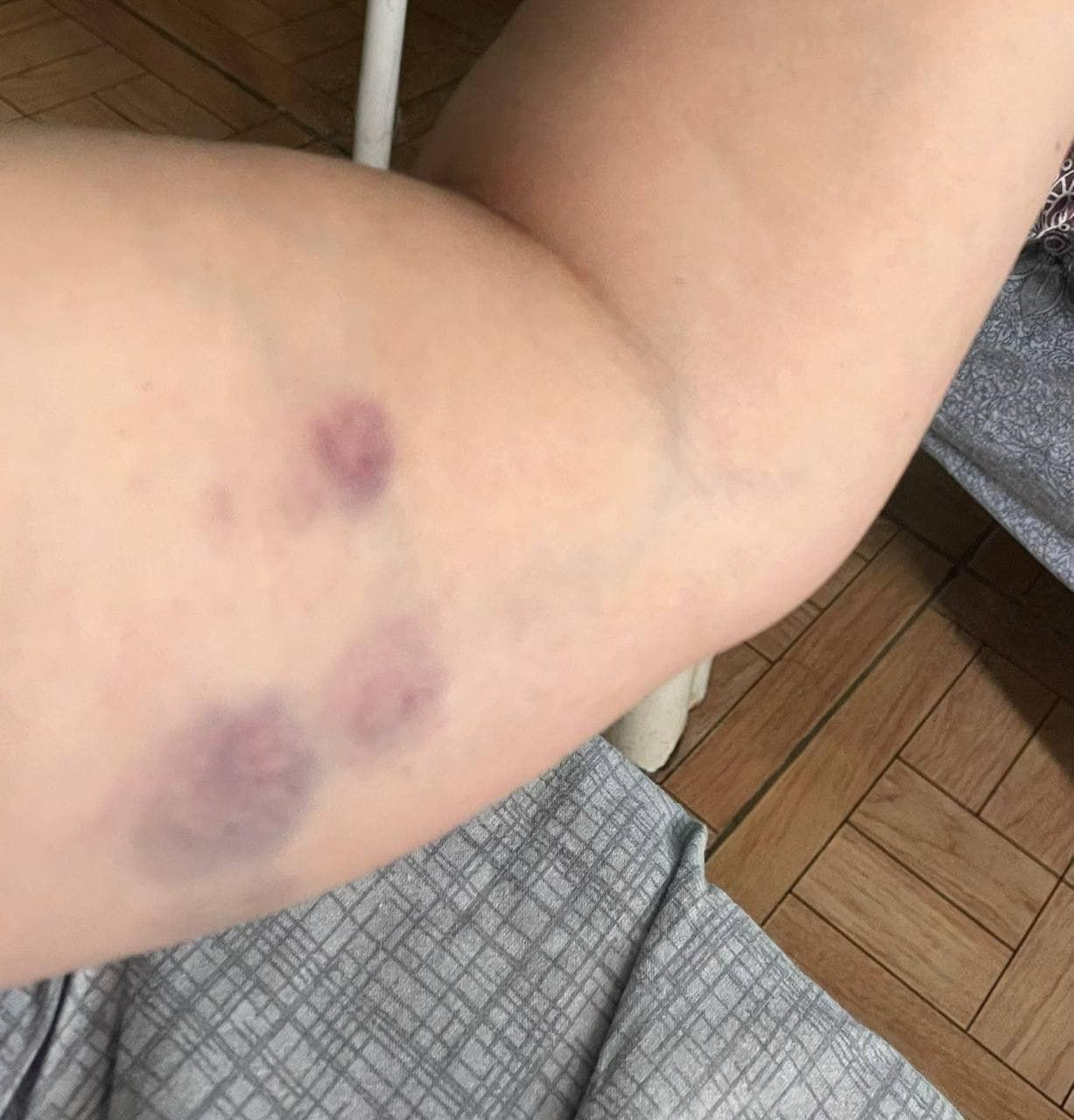 Участник СВО избил девушку в Башкортостане после грязных домог*тельств