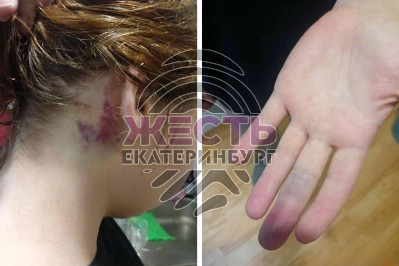 Екатеринбургская кондитерица Надежда пострадала от побоев своего нового...
