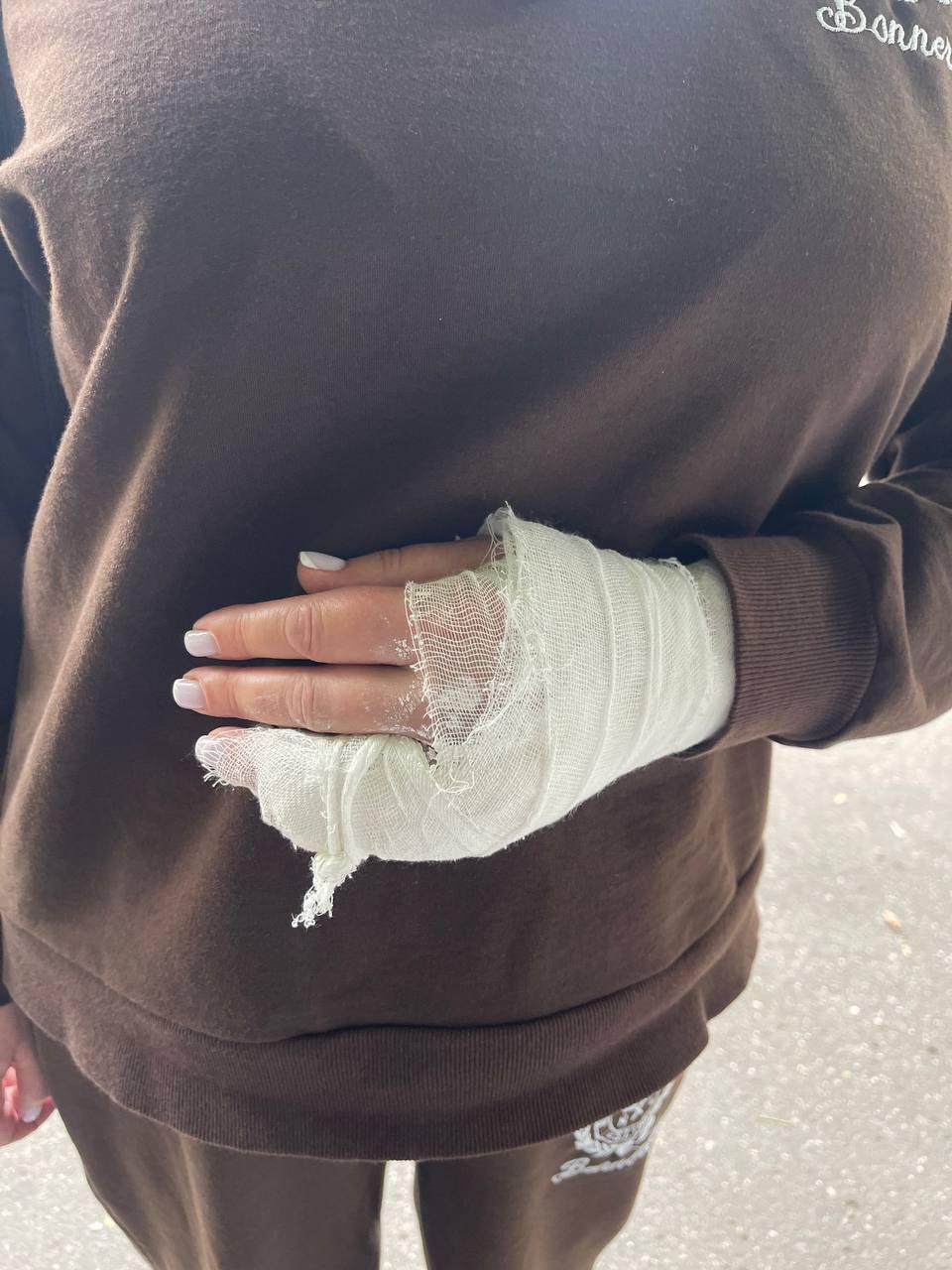 В подмосковном Одинцово банда на самокатах напала и ограбила женщину.
