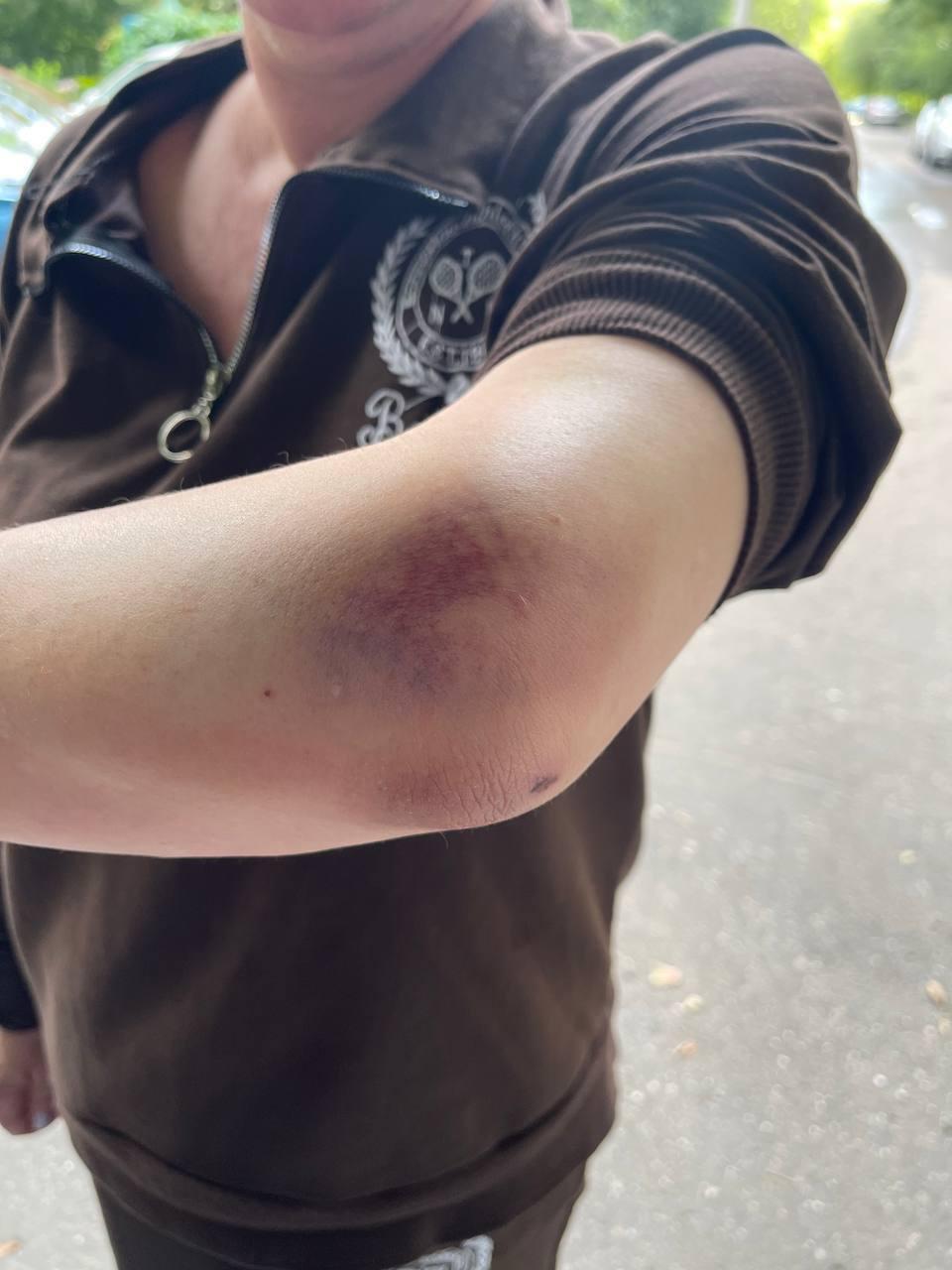 В подмосковном Одинцово банда на самокатах напала и ограбила женщину.