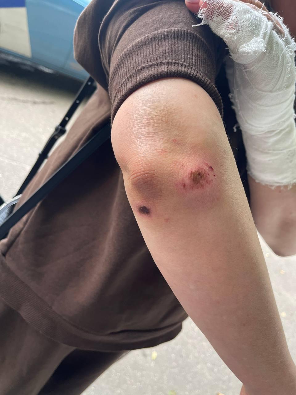 В подмосковном Одинцово банда на самокатах напала и ограбила женщину.