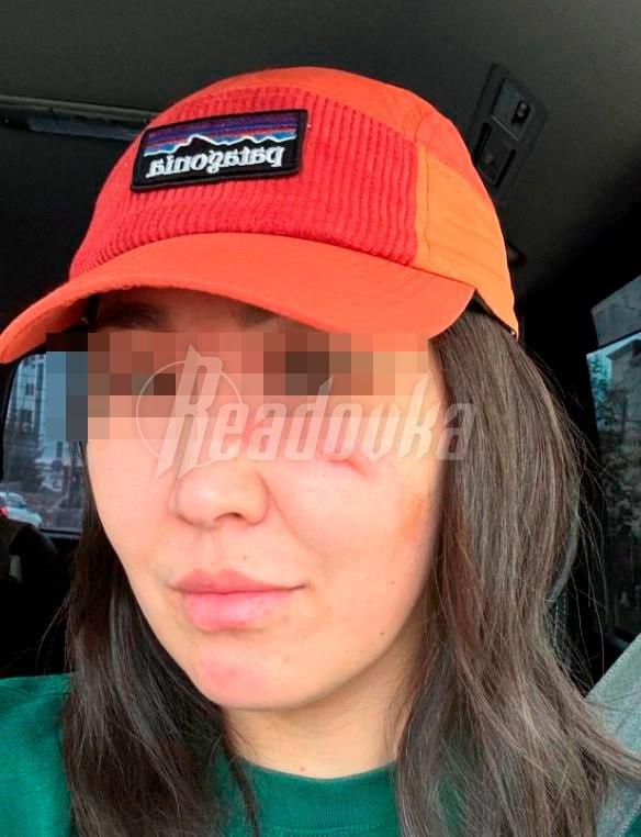 Диск от болгарки угодил в лицо жительнице Якутии во время ремонта
