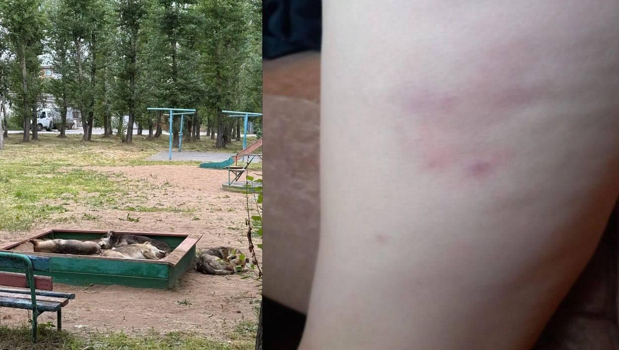 Бастрыкин потребовал отчёт по нападениям собак на детей в Ачинске. После...
