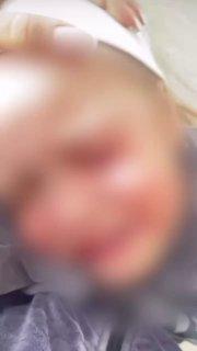 В Тюмени бойцовская собака напала на маленькую девочку и едва не разорвала ей лицо