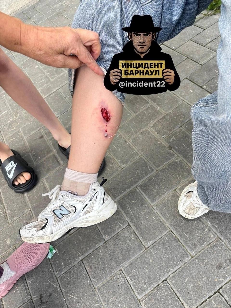 В Барнауле пес бойцовской породы сильно покусал 13-летнюю девочку. Собака...