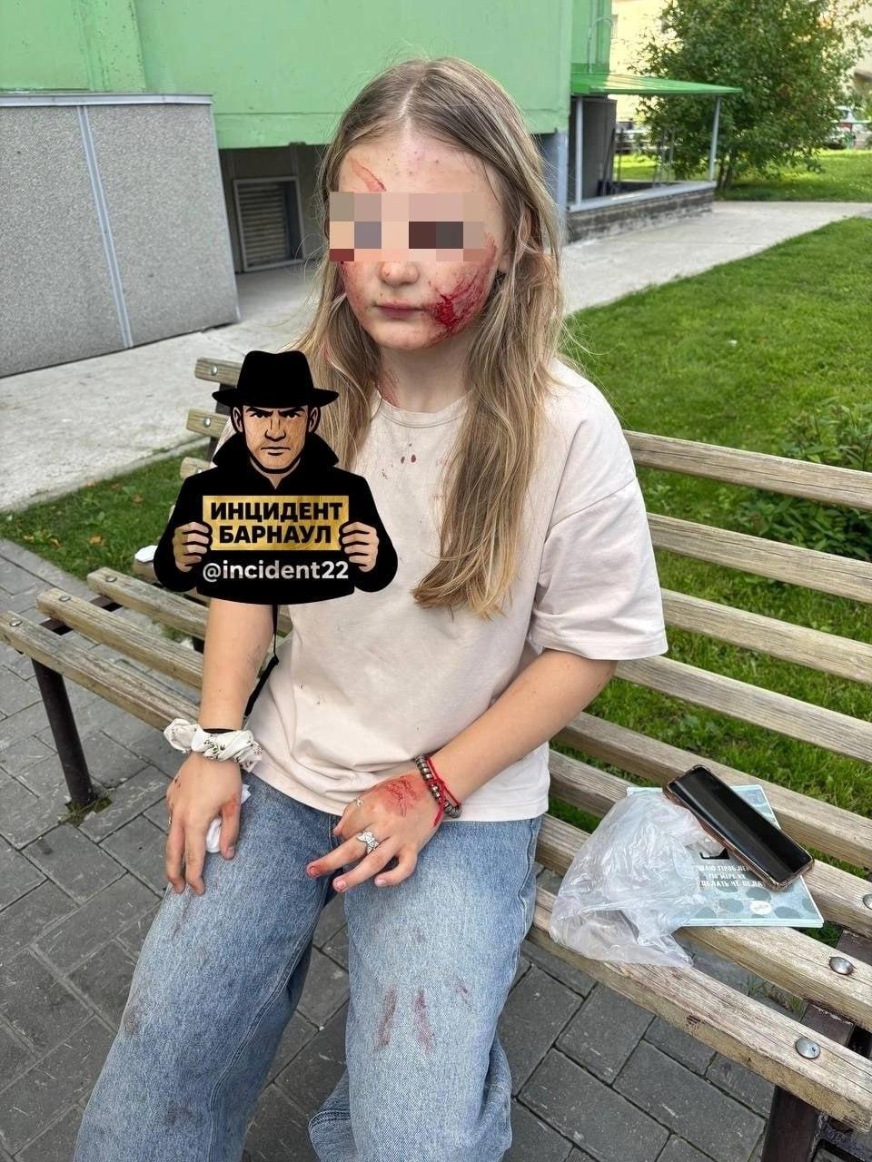 В Барнауле пес бойцовской породы сильно покусал 13-летнюю девочку. Собака...
