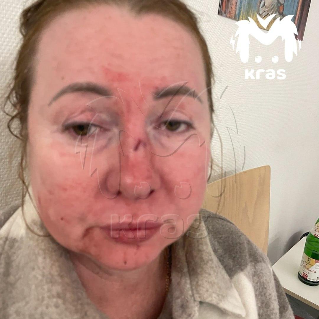 Родственники гендиректора красноярской УК пожаловались, что он избивает их в...
