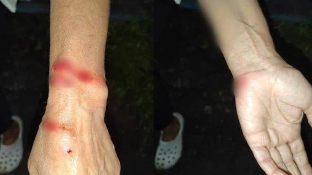 В Новосибирске собака на глазах хозяина напала на женщину